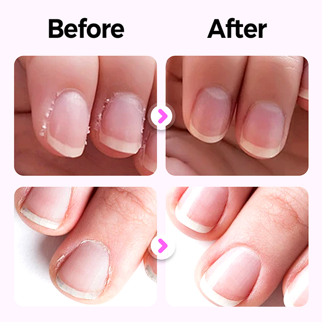 💜Hot Sale 50% OFF💜2025 New Upgraded 3-in-1 Nail Care Pen💅